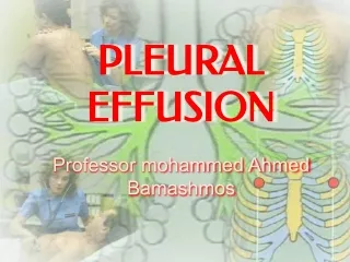 pleular Effusion