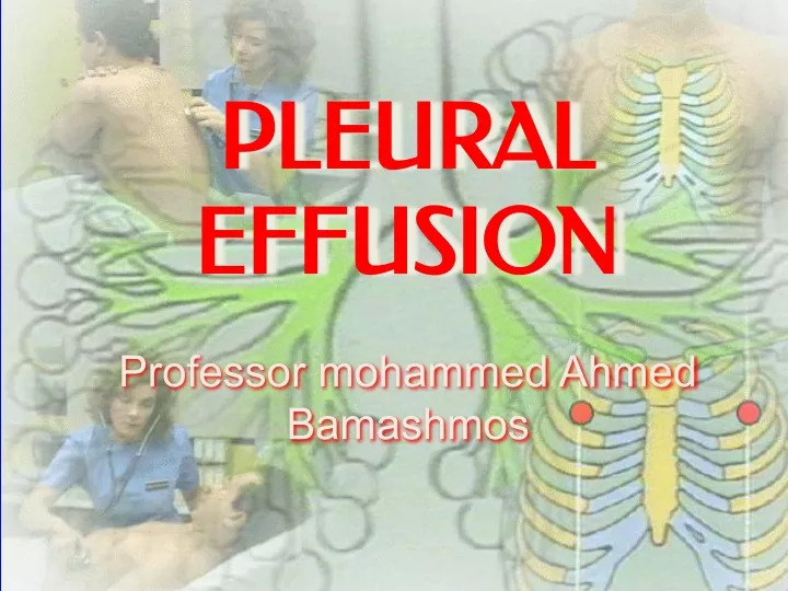 pleural pleural effusion effusion