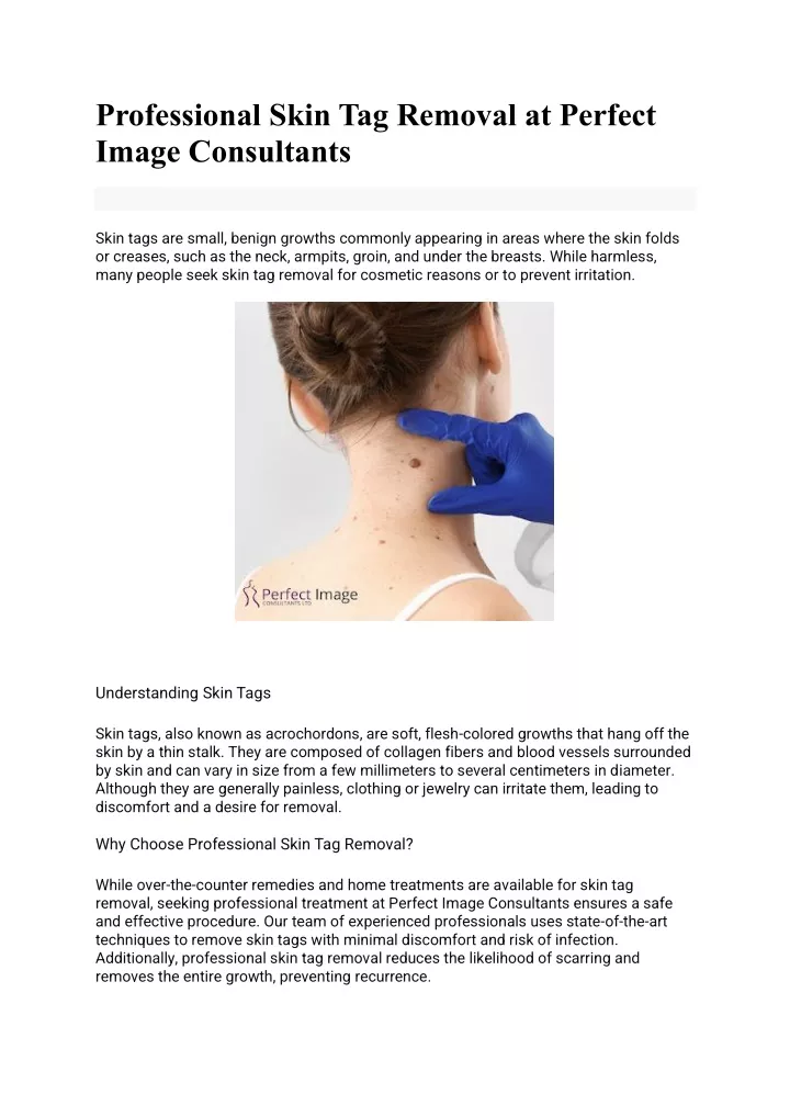 professional skin tag removal at perfect image