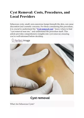 Cyst Removal Costs, Procedures, and Local Providers