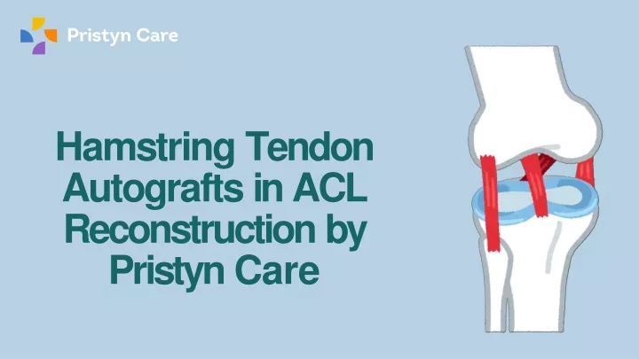 PPT - Hamstring Tendon Autografts in ACL Reconstruction by Pristyn Care ...