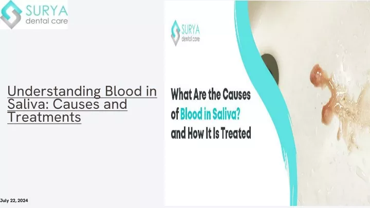 understanding blood in saliva causes