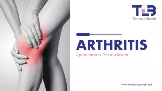 Arthritis Treatments, Symptoms & Causes - The Lotus Biotech