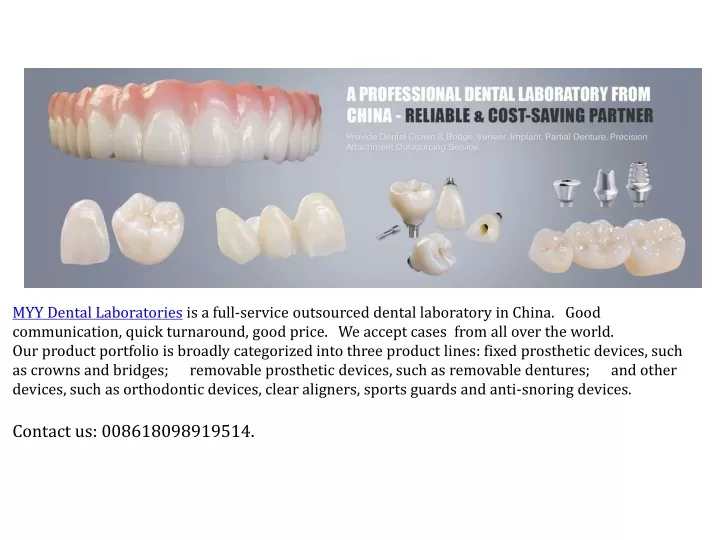 myy dental laboratories is a full service