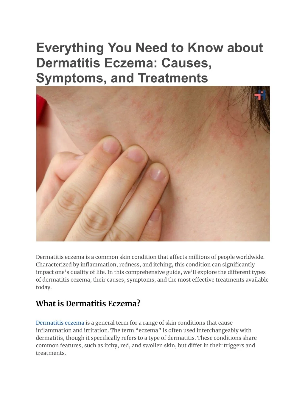 PPT - Everything You Need to Know about Dermatitis Eczema_ Causes ...
