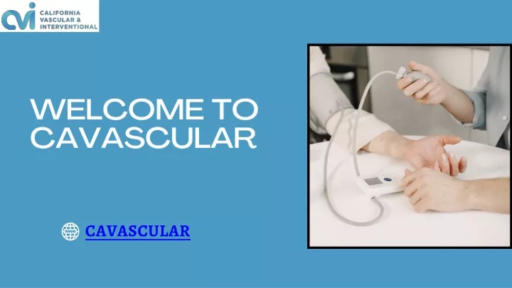 welcome to cavascular