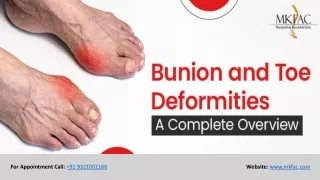 Bunion and Toe Deformities - A Complete Overview | MKFAC