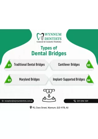 types-of-dental-bridges