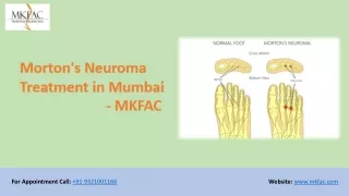 Morton's Neuroma Treatment in Mumbai | MKFAC