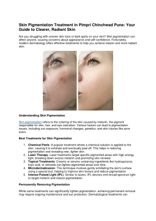 Skin Pigmentation Treatment in Pimpri Chinchwad Pune