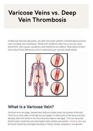 Varicose Veins vs. Deep Vein Thrombosis