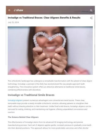 Invisalign vs Traditional Braces Clear Aligners Benefits & Results Shaw Jack Shaw Jack Published (2)