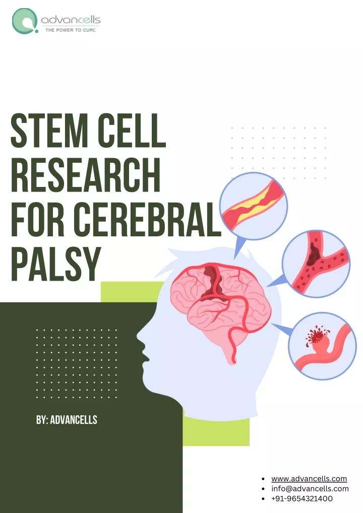 stem cell research for cerebral palsy