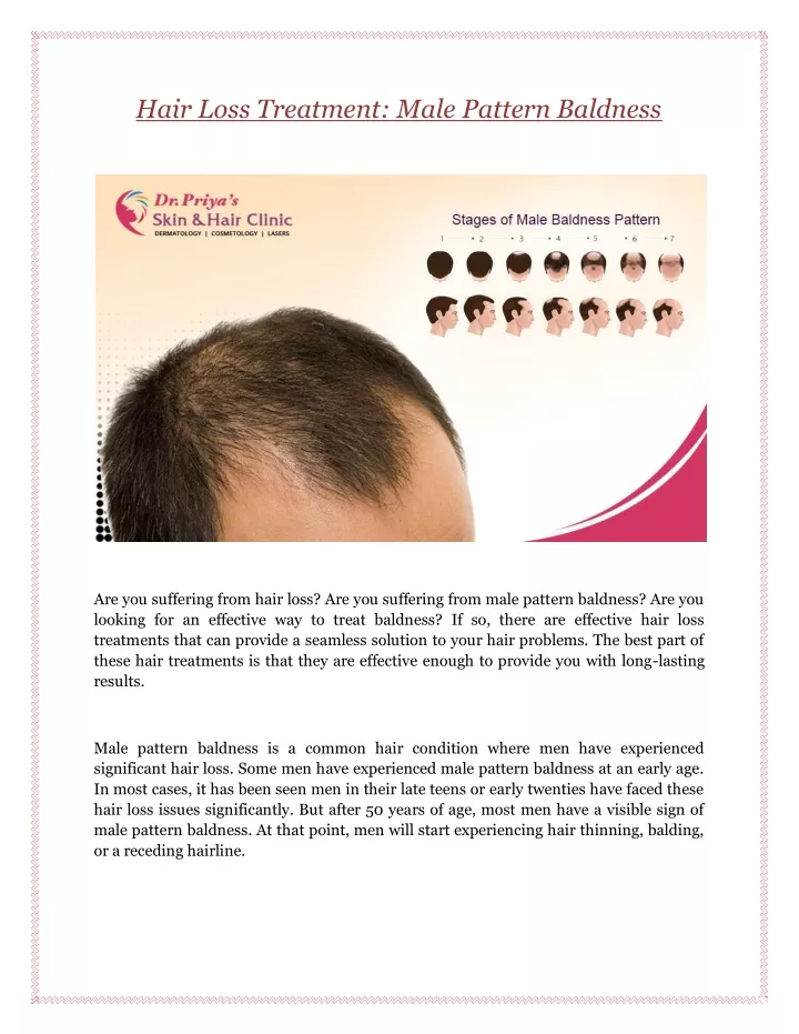 hair loss treatment male pattern baldness