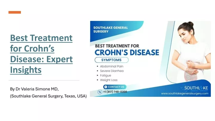 best treatment for crohn s disease expert insights