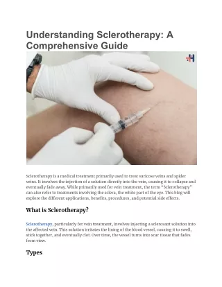 understanding sclerotherapy a comprehensive guide