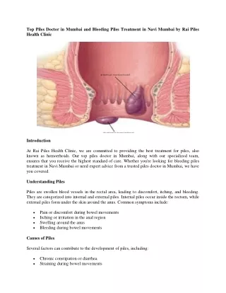 Top Piles Doctor in Mumbai and Bleeding Piles Treatment in Navi Mumbai by Rai Piles Health Clinic