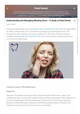 Understanding and Managing Bleeding Gums – A Guide at Petal Dental