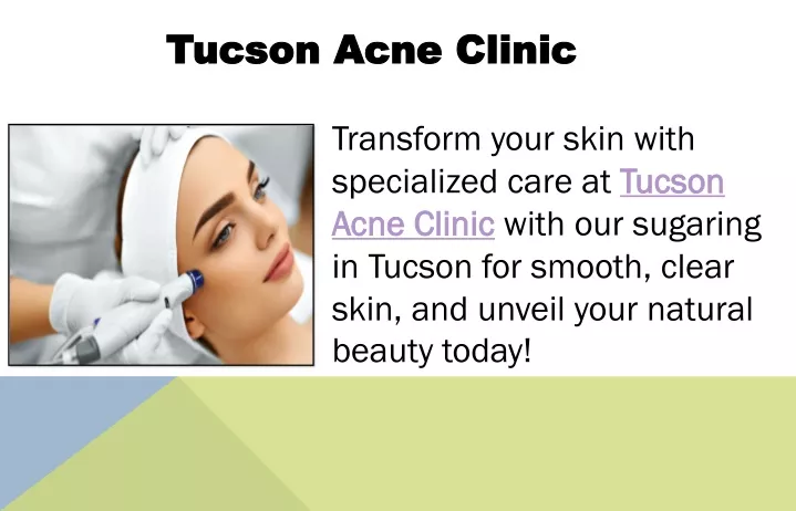 tucson acne clinic