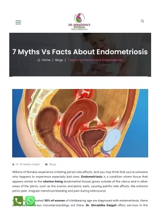 7 Myths Vs Facts About Endometriosis