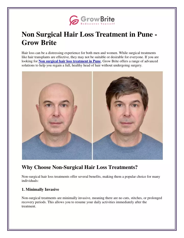 non surgical hair loss treatment in pune grow