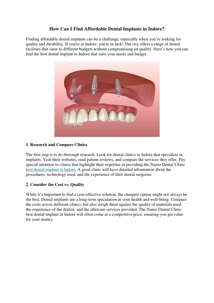 how can i find affordable dental implants