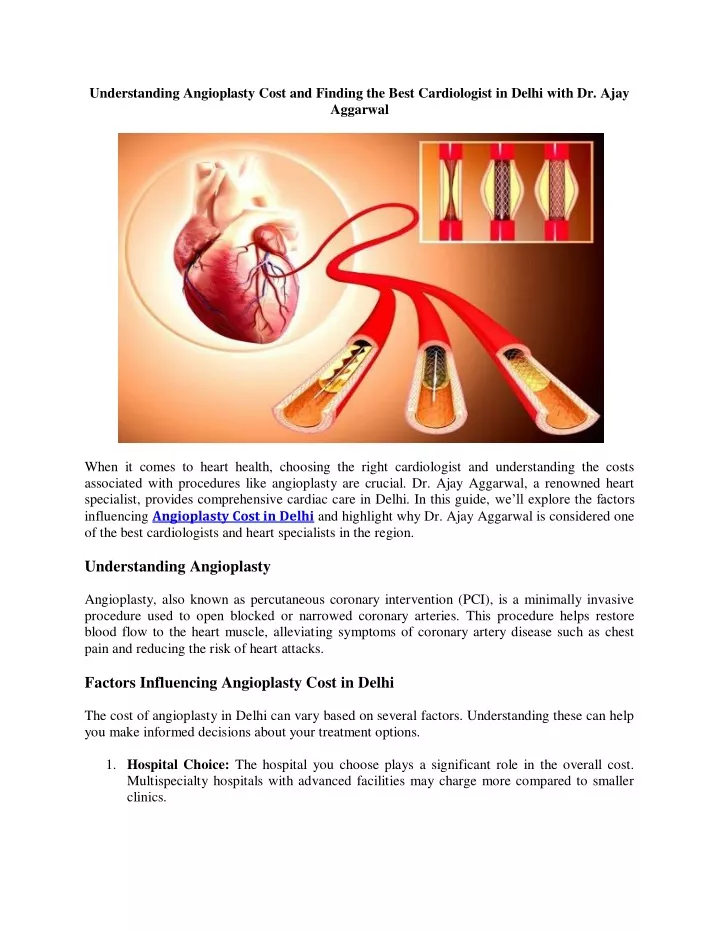 understanding angioplasty cost and finding