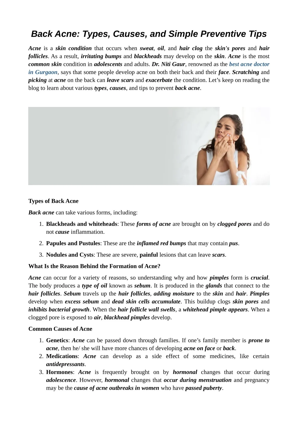 PPT - Back Acne: Types, Causes, and Simple Preventive Tips PowerPoint ...