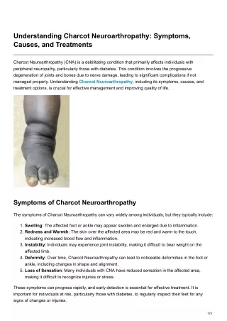 Understanding Charcot Neuroarthropathy Symptoms Causes and Treatments