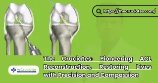 Best Surgeon in India