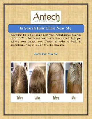 In Search Hair Clinic Near Me