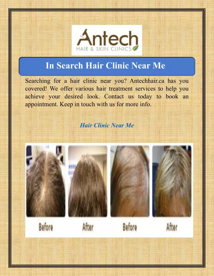 searching for a hair clinic near you antechhair