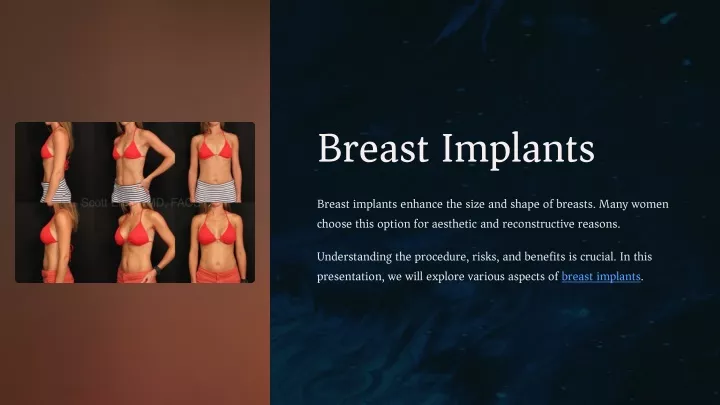 breast implants