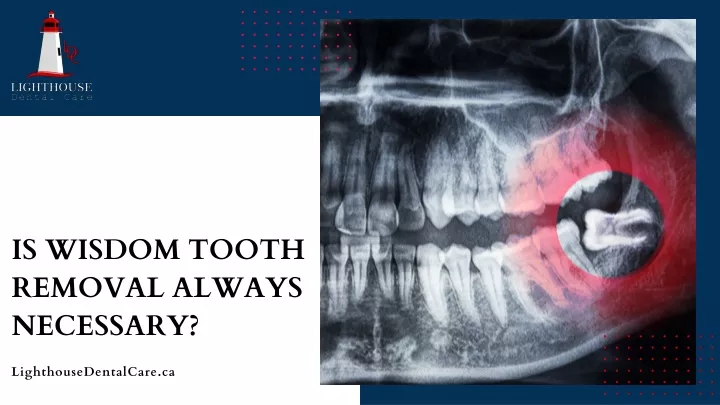 is wisdom tooth removal always necessary