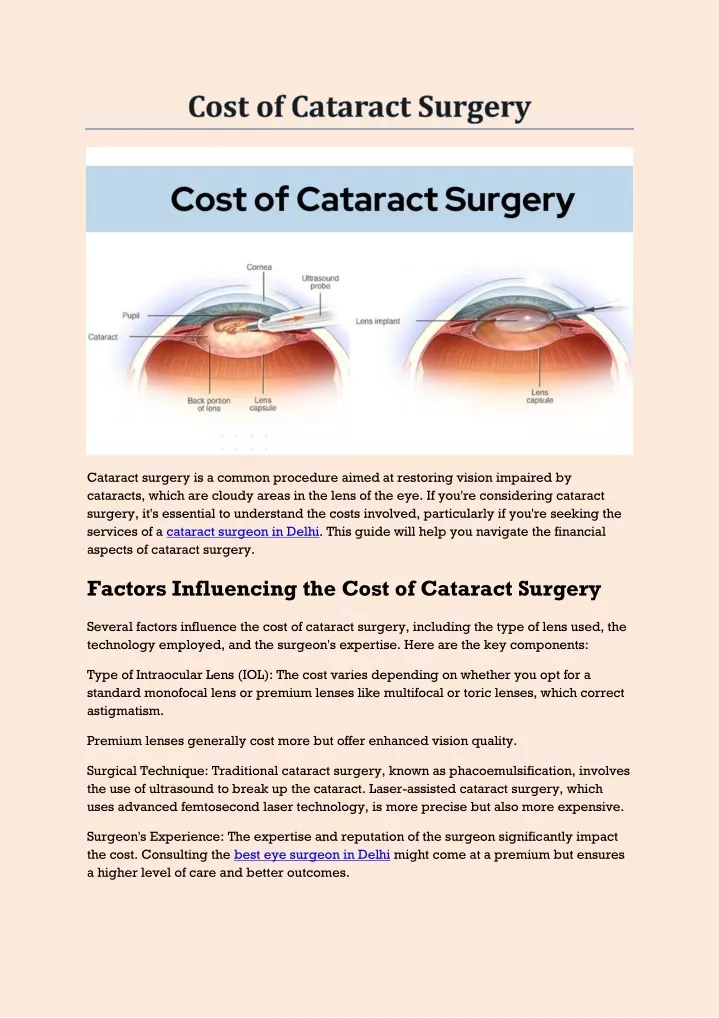 cataract surgery is a common procedure aimed