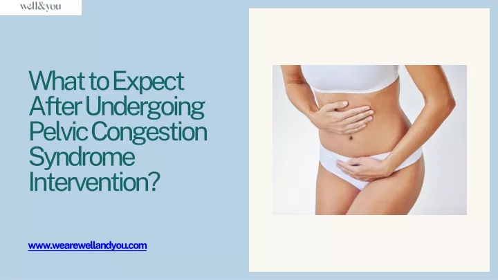 what to expect after undergoing pelvic congestion