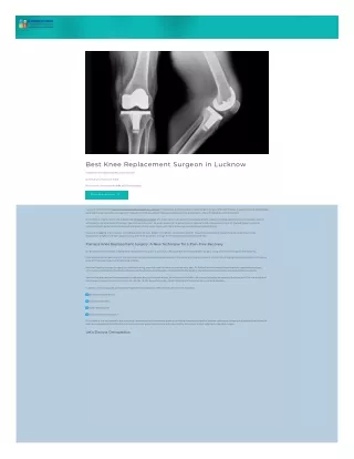 Best Knee Replacement Doctor in Lucknow