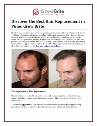 Achieve a New Look with the Best Hair Replacement in Pune