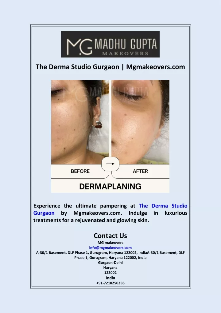 the derma studio gurgaon mgmakeovers com