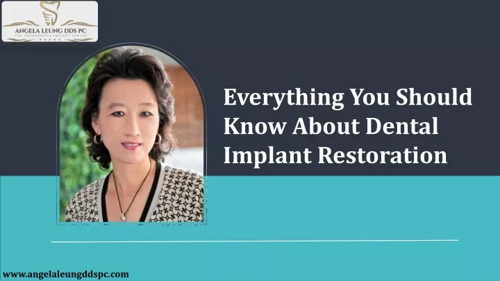 everything you should know about dental implant