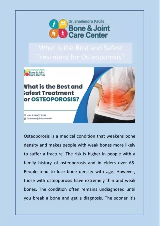 What is the Best and Safest Treatment for Osteoporosis