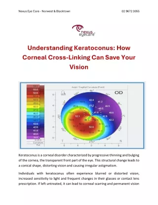 Understanding Keratoconus - How Corneal Cross-Linking Can Save Your Vision