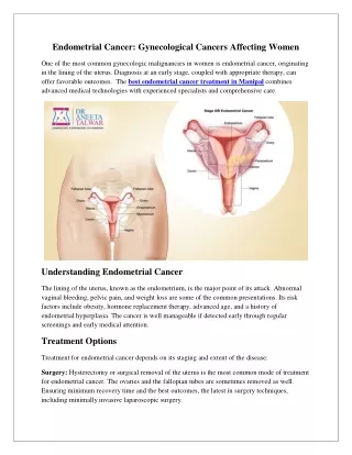 Endometrial Cancer Gynecological Cancers Affecting Women