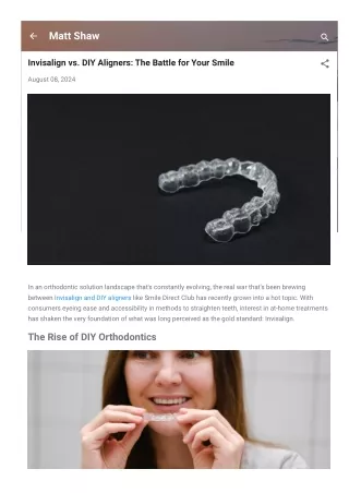 Invisalign vs. DIY Aligners The Battle for Your Smile