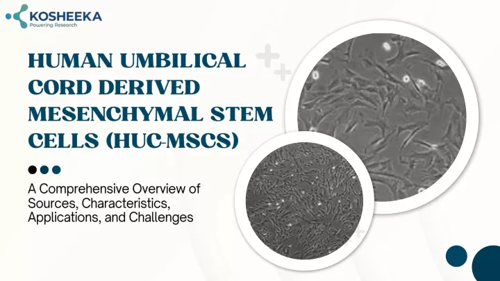 human umbilical cord derived mesenchymal stem