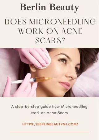 Does Microneedling work on Acne Scars ?