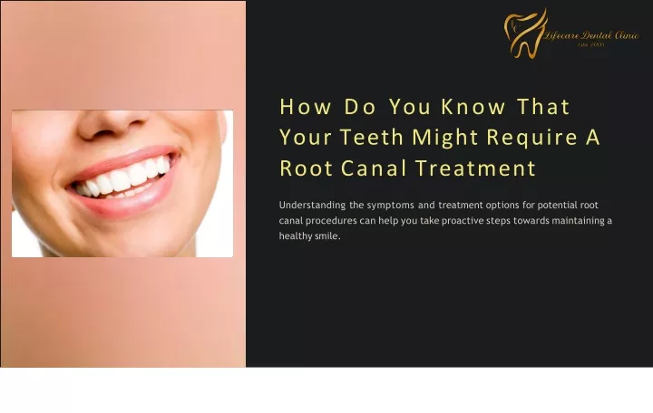 how do you know that your teeth might require