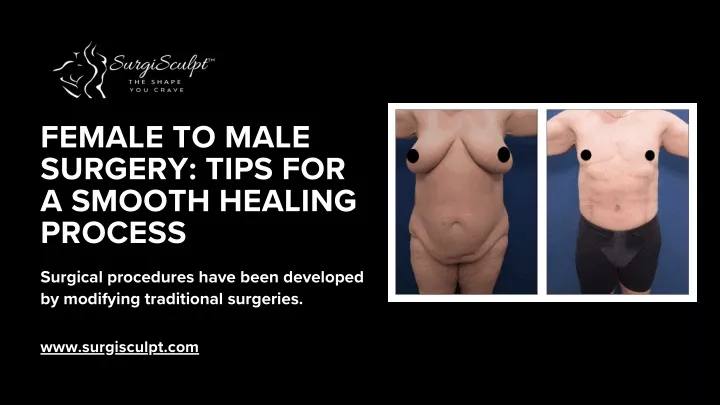 female to male surgery tips for a smooth healing