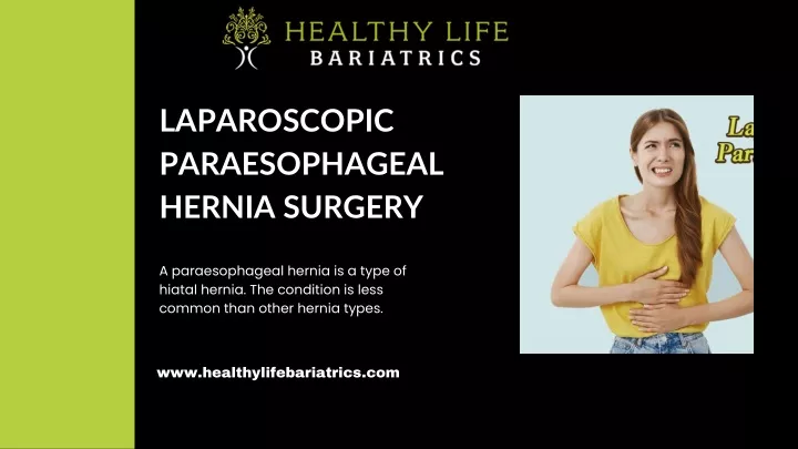 laparoscopic paraesophageal hernia surgery