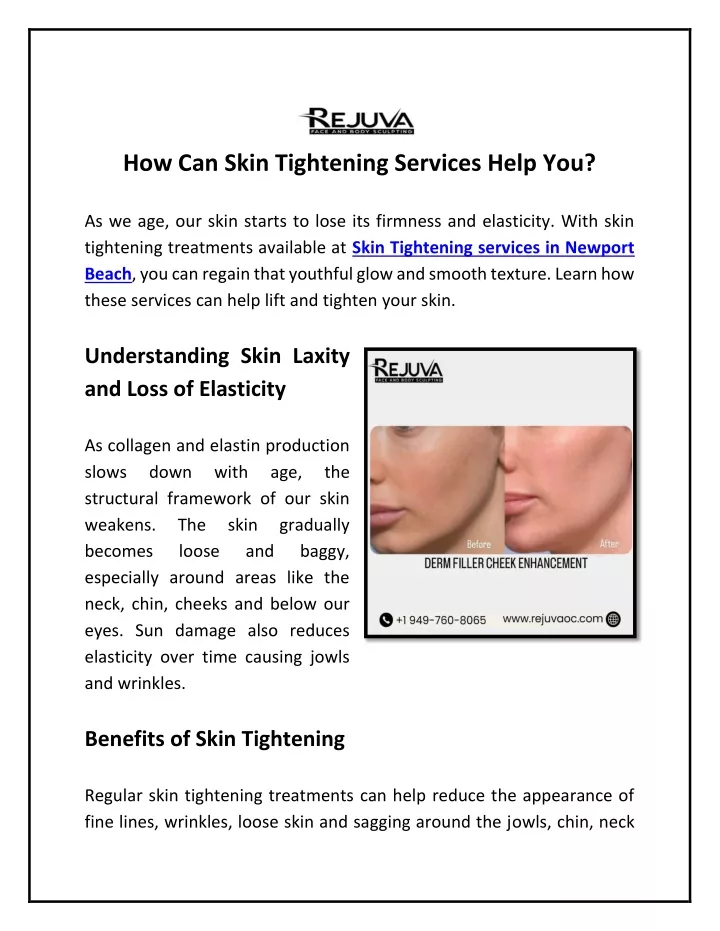 how can skin tightening services help you